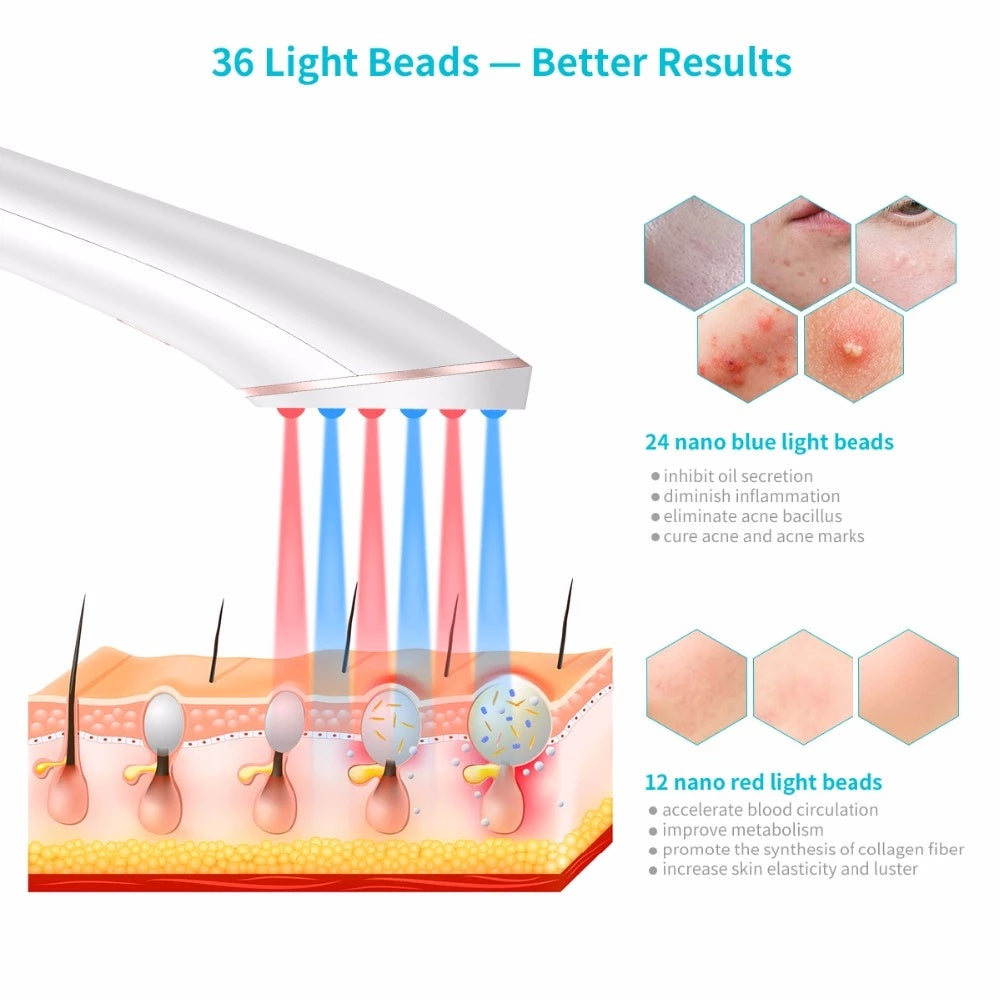 Acne Light Therapy Xpreen Wireless Device